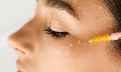 Enzimas Recombinantes y Lipolíticos​