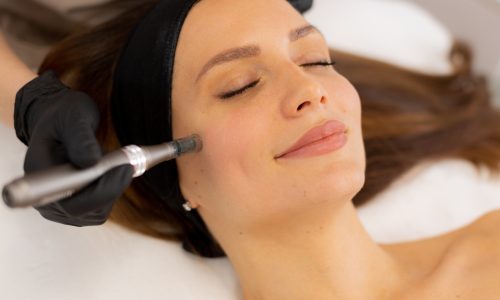 Mesoterapia Facial​