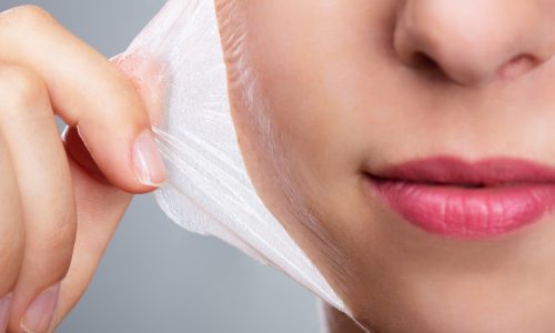 Peelings Médicos​