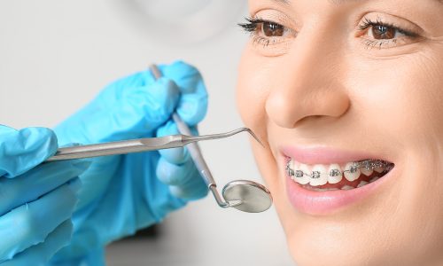 tratamiento de ortodoncia